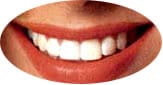 Dientes limpios … dientes sanos